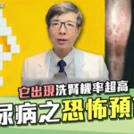 糖尿病恐怖預言家！拉褲管一看驚見「糖斑」醫師揭密糖尿病併發症 它一出現洗腎機率超高！冠心病、視網膜病變、糖尿病足通通來…超強5招逆轉 #糖尿病脛前黑斑｜腎寶思樂腎臟專科｜祝你健康