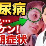 【糖尿病】この症状は既に危険！？放置厳禁なわかりにくい初期症状を見逃すな！