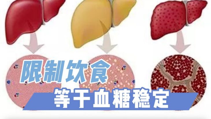 不一样的观点：糖尿病饮食控制的尽头，可能就是断食治疗（完整篇）