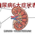 糖尿病6大症状表现