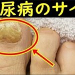 糖尿病の危険なサインがコレ！糖尿病を疑うべき症状やなりやすい人のタイプとは？