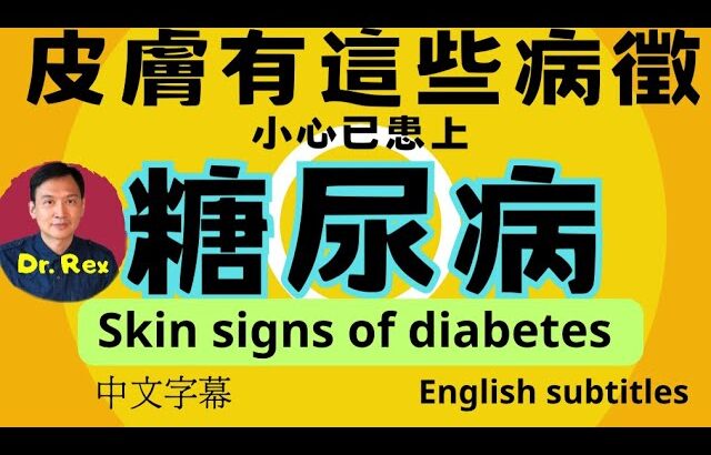 ￼留意這些糖尿病的皮膚徵狀！skin signs of diabetes