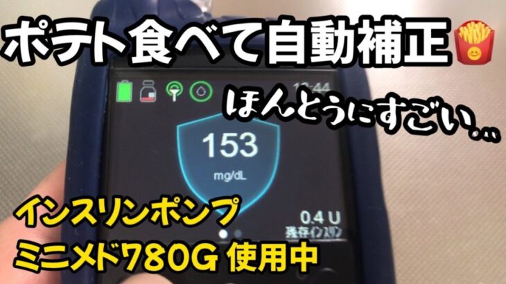 【1型糖尿病】ミニメド780Gの自動補正に頼ってポテト食べてみた