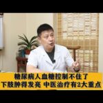 糖尿病人血糖控制不住了，下肢肿得发亮，中医治疗有2大重点