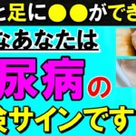 【放置禁止】実は糖尿病になっていると出やすい意外な「皮膚と足」の変化　医師が解説