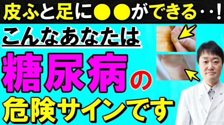 【放置禁止】実は糖尿病になっていると出やすい意外な「皮膚と足」の変化　医師が解説