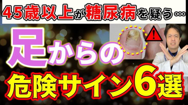 【見逃し厳禁⚠】知らないと絶対に後悔する、糖尿病でおきやすい足の症状を徹底解説！