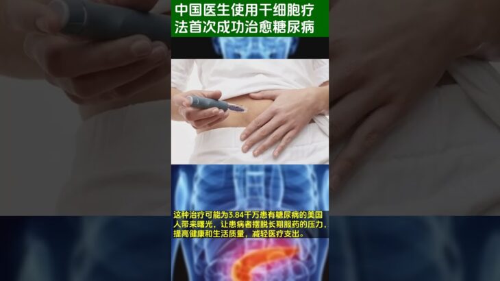 中国医生使用干细胞疗法首次成功治愈糖尿病 #shorts #health #diabetes