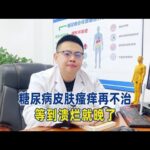 糖尿病皮肤瘙痒再不治，等到溃烂就晚了！【中醫治療糖尿病】