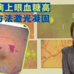 健康360 TVB｜糖尿病上眼血糖高  治療方法激光凝固 玻璃體藥物注射與玻璃體視網膜手術 視網膜病變分為非增殖性與增殖性 眼血管增生視力變模糊｜流行都市 宋芝齡 林凱恩 胡諾言 吳天佑