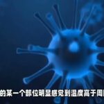 糖尿病足感染的5个表现，出现了要赶紧就医