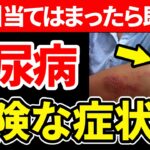 【放置厳禁】知らないと一生後悔！糖尿病のやばすぎる初期症状とは…【糖尿病・血糖値・HbA1c】