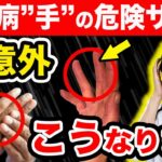 【放置厳禁】知らないと後悔する糖尿病『手』のSOSサイン【注意な合併症】初期症状を現役医師が簡単解説します。