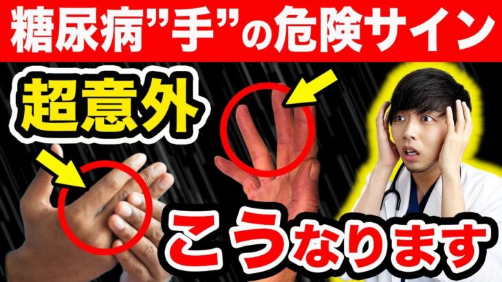 【放置厳禁】知らないと後悔する糖尿病『手』のSOSサイン【注意な合併症】初期症状を現役医師が簡単解説します。