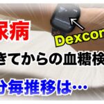 【糖尿病 Type1】糖尿病朝イチ起きてからの血糖値推移が気になる！１０分毎の血糖値をDexcomG7でモニタリングしてみた！