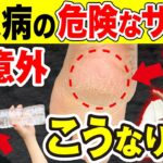 【放置厳禁】知らないと後悔する糖尿病の危険なサインとは？（血糖値・食事・ダイエット）