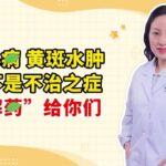 糖尿病 黄斑水肿 并不是不治之症！ “解药”给你们