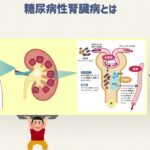 糖尿病合併症の検査の勧め