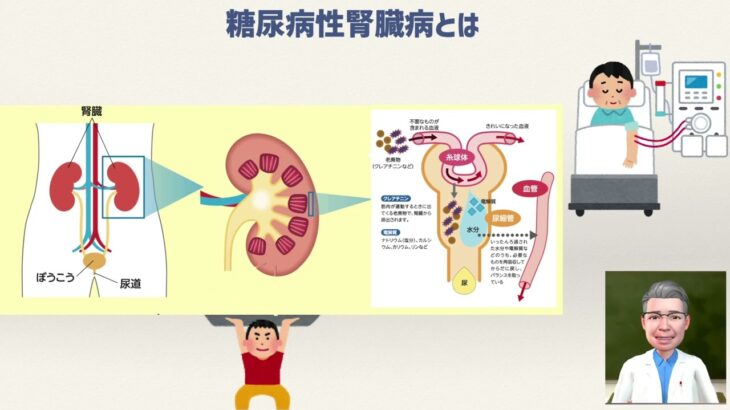 糖尿病合併症の検査の勧め