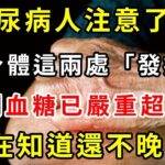 糖尿病人注意了！若身體這兩處「發癢」，說明血糖已嚴重超標！現在知道還不晚！再忙也要花2分鐘看看！趕緊轉發給家人！【養生驛站】