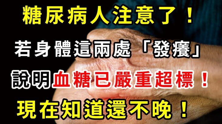 糖尿病人注意了！若身體這兩處「發癢」，說明血糖已嚴重超標！現在知道還不晚！再忙也要花2分鐘看看！趕緊轉發給家人！【養生驛站】