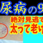 太って老化も加速させる糖尿病で起きやすい【細絡】寝ながら3分！セルフケア改善方法『老化防止・脂肪燃焼・代謝アップ・外反母趾・内反小趾・夜間頻尿・足がよくつる・腰痛・股関節痛・膝痛・動脈硬化』