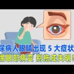 糖尿病人眼睛出现5大症状，警惕眼部病变，别拖成失明！｜#糖尿病 #血糖