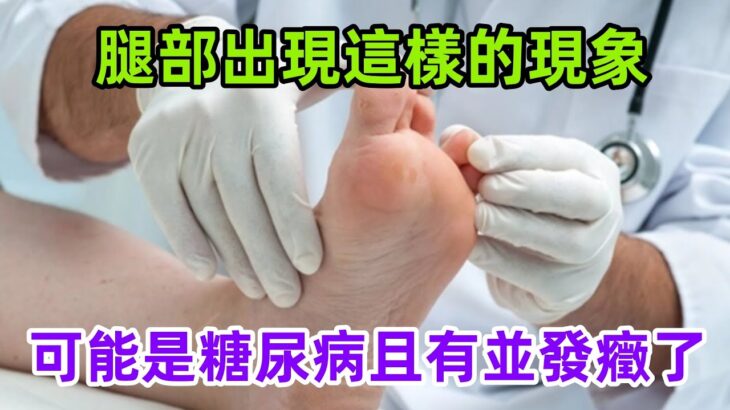 腿部出現這樣的現象，可能是糖尿病且有並發癥了#養生保健#健康#健康飲食