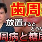 歯周病を放置すると？　歯周病と糖尿病の関係について