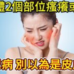 身體2個部位瘙癢，或是糖尿病信號，別以為是皮膚病