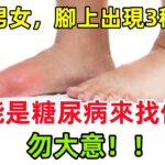 不論男女，腳上出現3種變化，可能是「糖尿病來找你了，勿大意」#健康常識#養生保健#健康#健康飲食