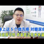 身上這5個地方疼，對糖尿病人來說很可怕，併發症正在步步逼近！｜#糖尿病 #血糖