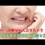 80%的糖尿病人會牙齒不全，如果你不想牙齒掉光，跟我學3招！｜#糖尿病 #血糖