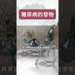 糖尿病的發物已列出，第一名並非糖，不少人喜歡吃【健康管家】