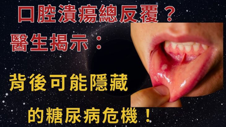 口腔潰瘍總反覆？醫生揭示：背後可能隱藏的糖尿病危機！知道早受益！【幸福老人生】#糖尿病#口腔潰瘍