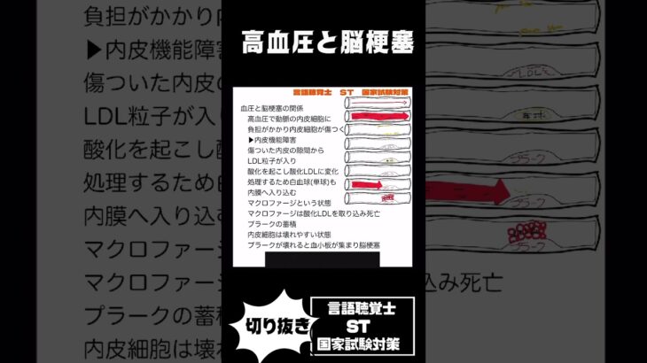 運動療法のリスク管理　脳梗塞　糖尿病　多発筋炎　急性心筋梗塞　慢性閉塞性肺疾患