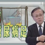 【大愛醫生館】 燒烤糖尿病足 20240924