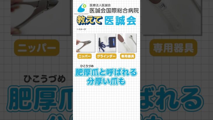 【教えて医誠会】糖尿病の足トラブルとフットケア～第3回 糖尿病看護外来で行っているフットケア～ #shorts