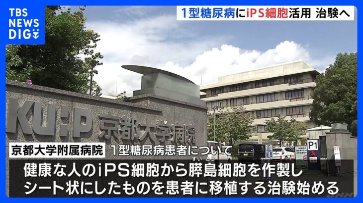 京都大学病院が“糖尿病治験”へ iPS細胞から膵島細胞を作製 「インスリン注射不要」への期待｜TBS NEWS DIG