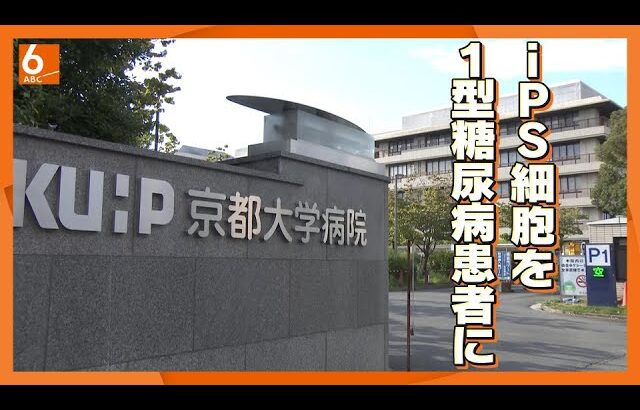 【「iPS細胞」を１型糖尿病患者に】来年2月にも治験開始　2030年以降の実用化目指す　京大附属病院