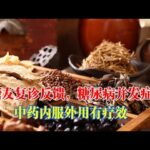 糖尿病人堅持泡腳後復診！見証中藥內服外用有療效！｜#糖尿病 #血糖