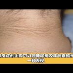 糖尿病前期有什么症状？如何预防？#科普 #健康 #知识