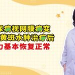 糖尿病视网膜病变 双眼黄斑水肿治疗后 视力基本恢复正常