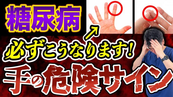 絶対に放置するな！糖尿病によって「手」に現れる症状とは”