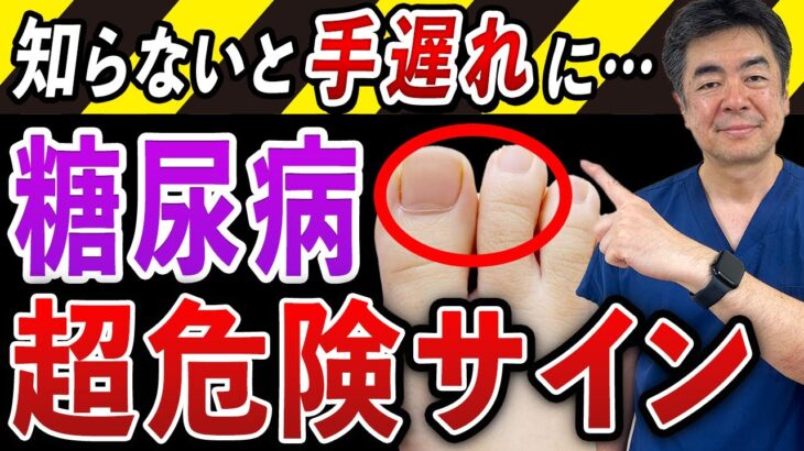 【放置厳禁】思い当たったら今すぐ病院へ！足に現れる糖尿病の初期症状”