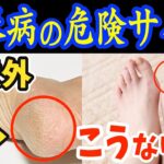 朝に1個‼食べるだけで血糖値・HbA1cを下げて糖尿病を86％も自力で治す?最強の朝食と知らないと後悔する糖尿病の危険サイン！と寝ながら腰振るだけ！怖いくらい血糖値を下げて脊柱菅狭窄症・腰痛まで解消！