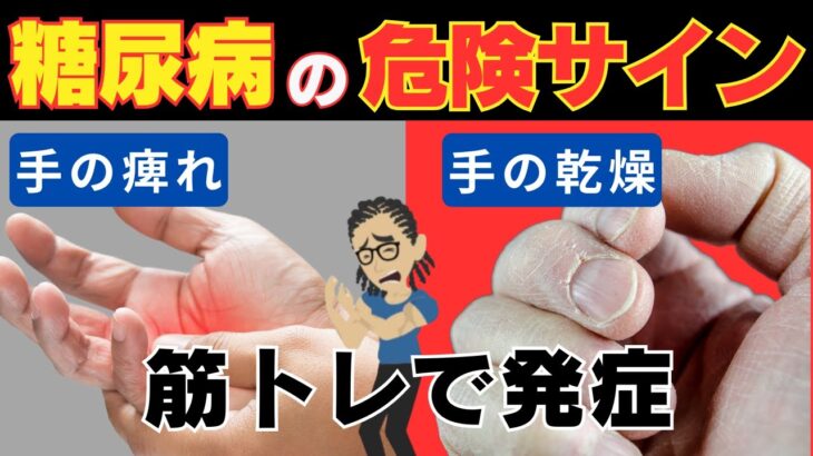 【理学療法士監修】トレーニーが陥りやすい糖尿病の手からの危険サイン5選　~予防方法も徹底解説~