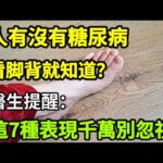 【乐厨怡妈】人有沒有糖尿病，看脚背就知道？醫生提醒：這7種表現千萬別忽視。