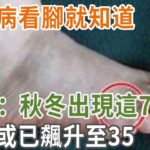 糖尿病看腳就知道！醫生：秋冬出現這7表現，血糖或已飆升至35|養之道