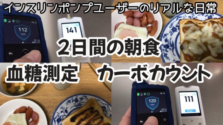 【1型糖尿病】2日間の朝食内容・血糖測定・カーボカウント　インスリンポンプ　ミニメドMiniMed780G使用中